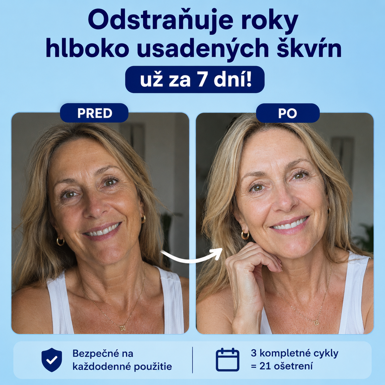 PAP+ Pokročilé bieliace pásiky na zuby