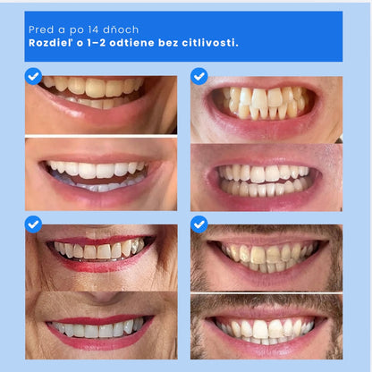 Prášok pre prirodzene belší úsmev